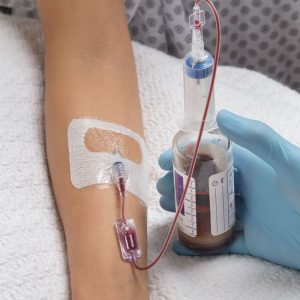 The Kurin PIV enables diversion for blood culture collection from a fresh peripheral IV catheter.