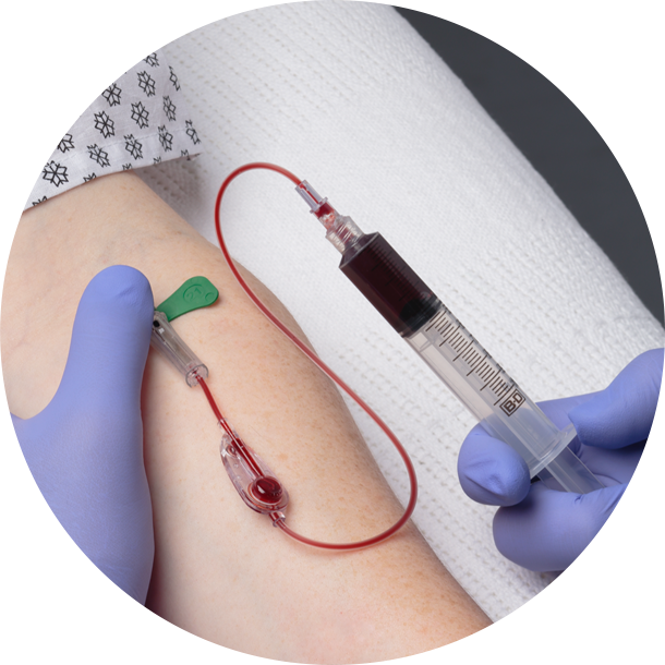 Kurin Lock® with Flash Technology Better than conventional diversion